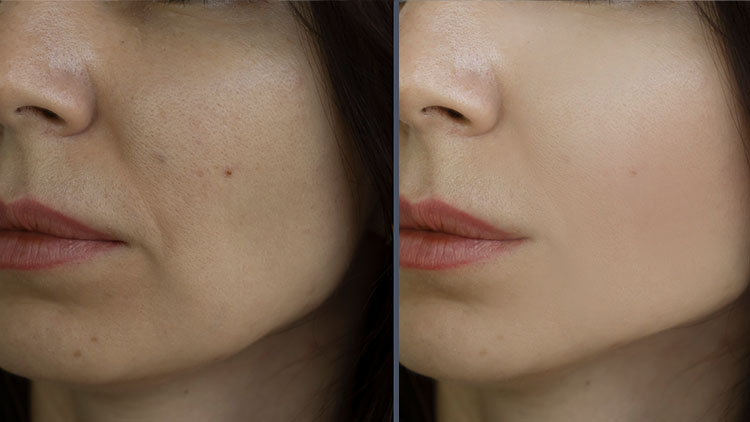 scapa de tenul uscat