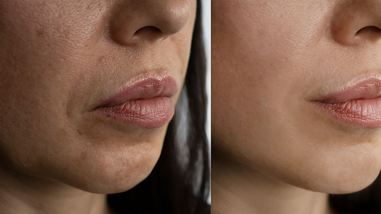 ten hidratat si curatat