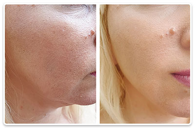 fata intinerita fara riduri