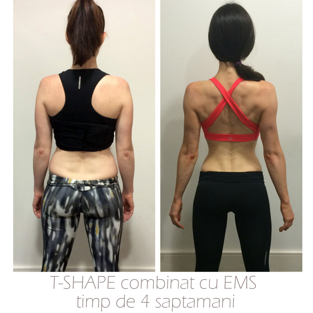 elimina depozitele de grasime