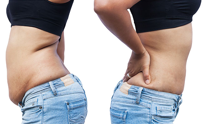 remodelare corporala