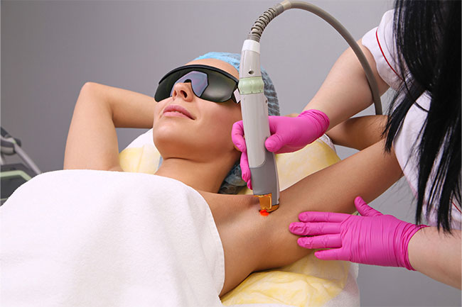 epilare definitiva cu laser in Iasi