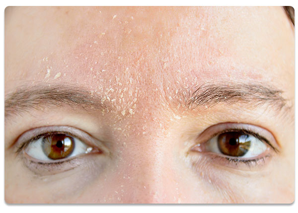 ten uscat, oxigen hiperbaric